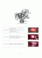 자궁근종 uterus myoma 2페이지