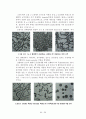 미세 조직 관찰 (al-mg alloy, cast iron) 37페이지