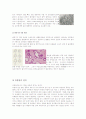 유방암에 대한 조사 정리 6페이지