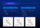 뇌졸중에 대한 발표자료 7페이지