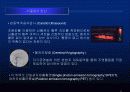 뇌졸중에 대한 발표자료 13페이지