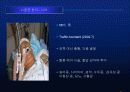 뇌졸중에 대한 발표자료 34페이지