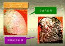 담배와 건강 17페이지