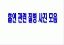 흡연의 폐해 23페이지