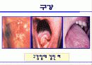 흡연의 폐해 28페이지