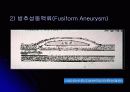 뇌 동  맥 류(Cerebral Aneurysm) 5페이지