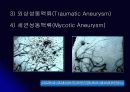 뇌 동  맥 류(Cerebral Aneurysm) 6페이지