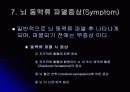뇌 동  맥 류(Cerebral Aneurysm) 10페이지