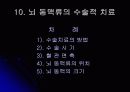뇌 동  맥 류(Cerebral Aneurysm) 13페이지