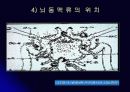 뇌 동  맥 류(Cerebral Aneurysm) 17페이지