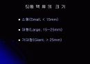 뇌 동  맥 류(Cerebral Aneurysm) 18페이지