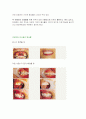 치아이식과 인공치아 11페이지