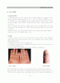 습진(eczema)바로알기 15페이지