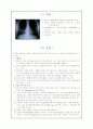 아동간호학 case study - Pneumonia(폐렴) 20페이지