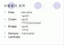 보철에 관한 정리 4페이지