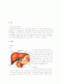 [Case study]LC(간경화)에 대한 사례보고서 1페이지