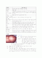 [Case study]LC(간경화)에 대한 사례보고서 7페이지