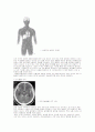 중화자실 case (SAH) 4페이지