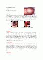 간경변증(문헌고찰-그림다수포함) 8페이지