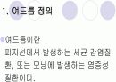 청소년을 대상으로한 여드름 예방 및 치료 교육 발표 4페이지