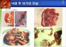 낙태와 피임 12페이지