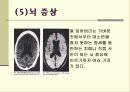 [보건교육] 에이즈(AIDS) 14페이지