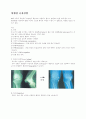반월상 연골손상과  퇴행성 슬관절염 4페이지