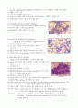 Leukemia의 분류 7페이지