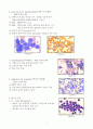 Leukemia의 분류 9페이지