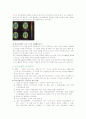 정신분열증 (schizophrenia) 문헌고찰 및 간호사정 2페이지