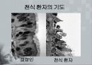 아동간호학 발표 천식(ASTHMA) 9페이지