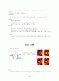 불안정형 협심증 case study 11페이지