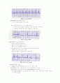 심부정맥 종류와 간호 2페이지