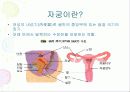 임상병리  자궁질환에 대해서 3페이지