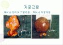 임상병리  자궁질환에 대해서 24페이지