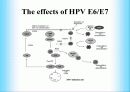 인간 유두종 바이러스에 관해서(HPV:Human papillomavirus) 12페이지