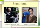 MND(Lou Gehrig’s disease -근위축성 측삭 경화증-) 13페이지