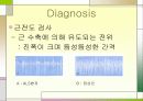 MND(Lou Gehrig’s disease -근위축성 측삭 경화증-) 14페이지