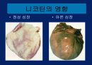 흡연교육 파워포인트 3페이지