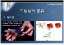 피임의 모든것!!  [피임에 관한 모든것(시장,제품,경향,설문조사,피임법등등)을 정리했습니다.] 30페이지