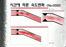 플라크에 의한 혈관 내부 유동장 해석 17페이지