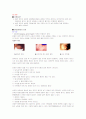 성병의 종류와 예방법, 피임종류와 방법 3페이지