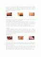 성병의 종류와 예방법, 피임종류와 방법 7페이지