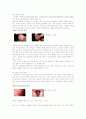 성병의 종류와 예방법, 피임종류와 방법 8페이지