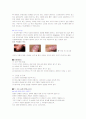 성병의 종류와 예방법, 피임종류와 방법 10페이지