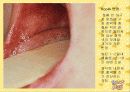 아동간염성 질환 31페이지