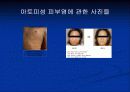 새집증후군 10페이지