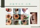 균일부식(Uniform Corrosion) 9페이지