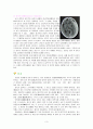 SDH case study 3페이지