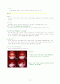 자궁근종(myoma) case study 4페이지